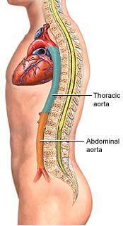 The Aortic Anatomical Segments from Thoracic to Abdominal and Pelvic