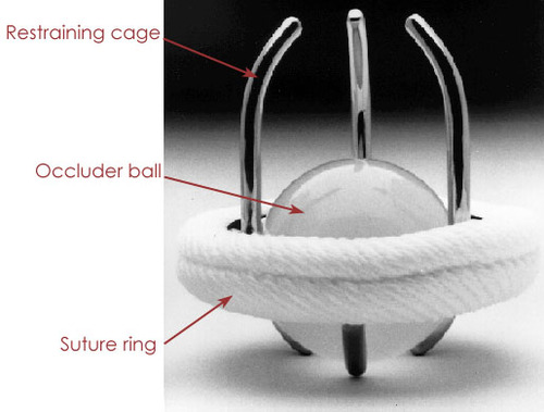 artificial-mechanical heart valve replacement