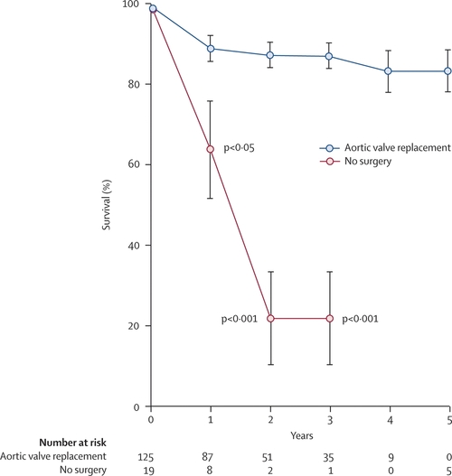 minimally invasive aortic valve surgery