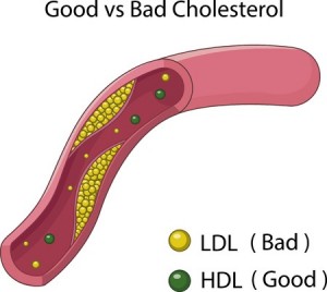 Good and Bad Cholesterol Defined