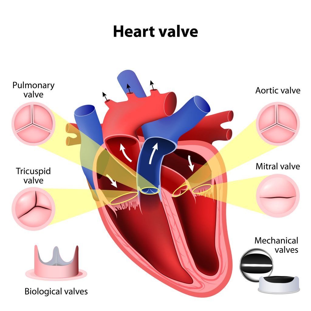 Types of Mechanical Heart Valves Dr. Ciuffo Heart Surgery