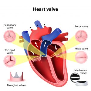 Mechanical heart valve