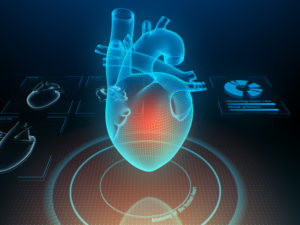 Aortic Valve Replacement