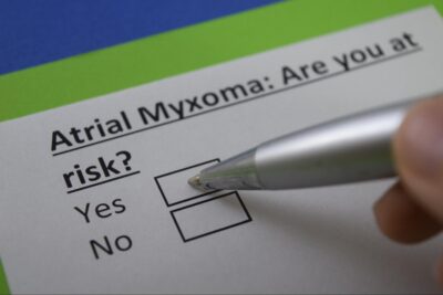 The Heart Tumor No One Talks About: Atrial Myxoma Symptoms You Might Miss